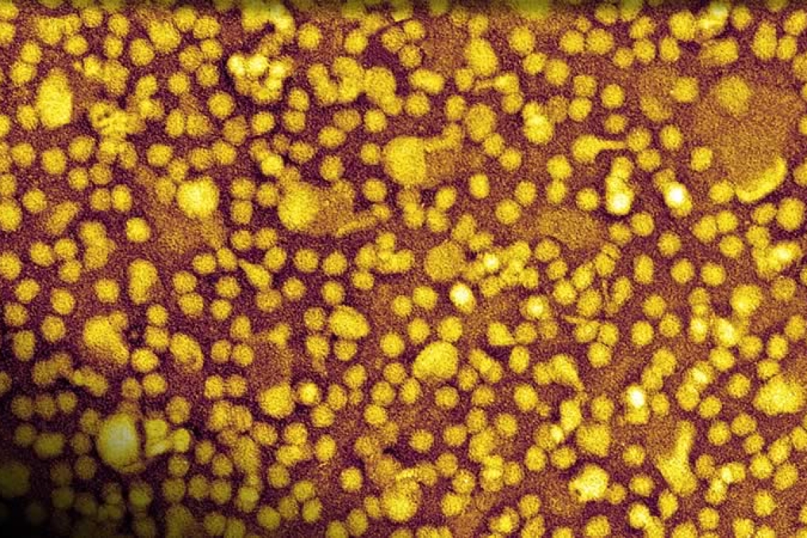 ¿Una sola inyección para controlar el colesterol de por vida? Un estudio señala que podría ser posible