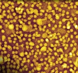 ¿Una sola inyección para controlar el colesterol de por vida? Un estudio señala que podría ser posible